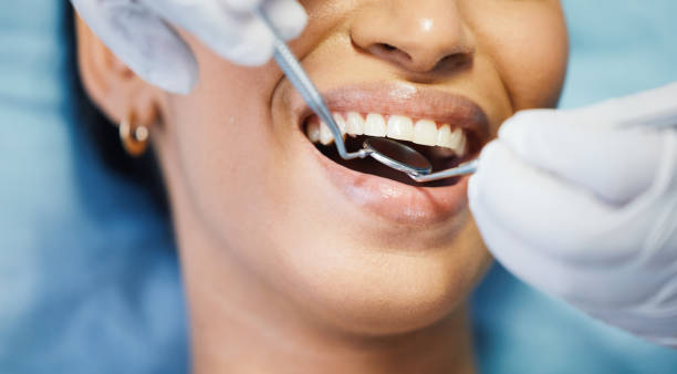 Best Emergency Treatment for Dental Infections or Abscesses in Chandler, AZ